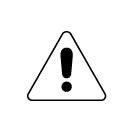 Alert Icon